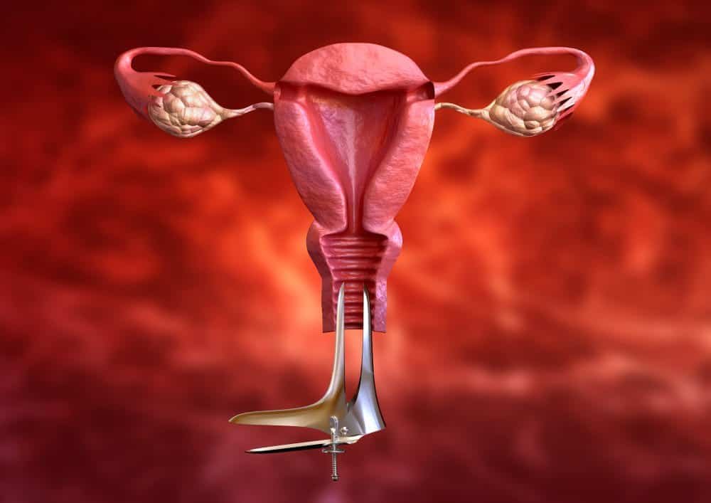uterine fibroid embolization side effects