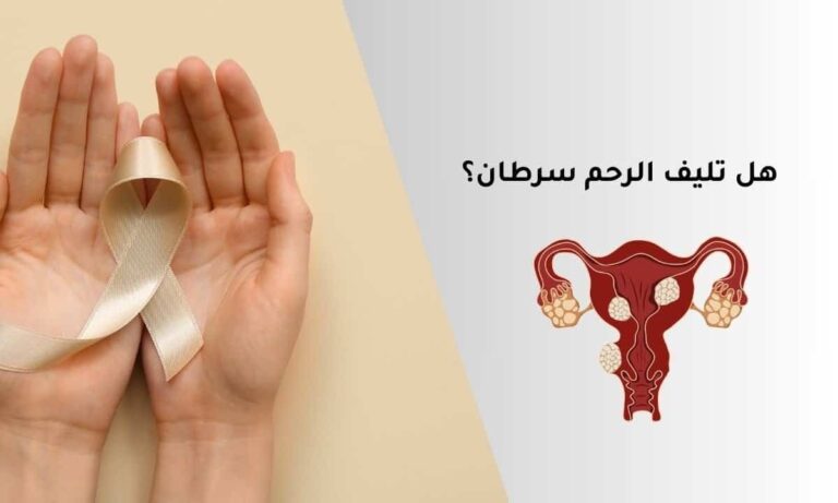 هل تليف الرحم سرطان