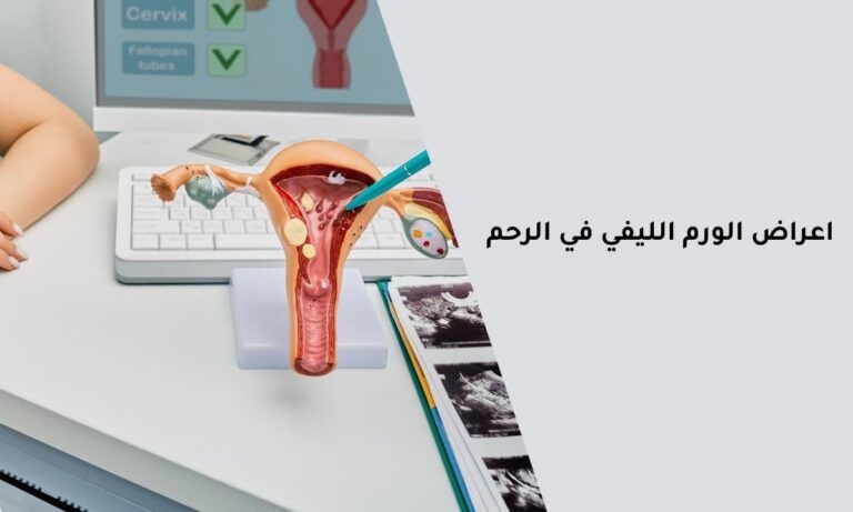 اعراض الورم الليفي في الرحم